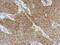 DAZ Interacting Zinc Finger Protein 3 antibody, GTX124219, GeneTex, Immunohistochemistry paraffin image 