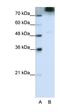 Eukaryotic Translation Initiation Factor 3 Subunit B antibody, orb324865, Biorbyt, Western Blot image 