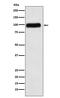 Serpin Family G Member 1 antibody, M01221, Boster Biological Technology, Western Blot image 