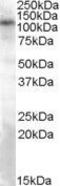 Transient Receptor Potential Cation Channel Subfamily C Member 4 antibody, GTX88652, GeneTex, Western Blot image 