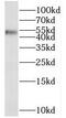 Transcription Factor Dp-2 antibody, FNab08625, FineTest, Western Blot image 
