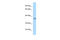 Voltage-gated hydrogen channel 1-like antibody, ARP35377_P050, Aviva Systems Biology, Western Blot image 