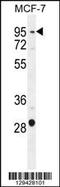 Patched Domain Containing 3 antibody, 55-829, ProSci, Western Blot image 