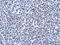 Arginine And Serine Rich Protein 1 antibody, NBP2-15641, Novus Biologicals, Immunohistochemistry frozen image 