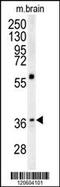 Microtubule Associated Protein RP/EB Family Member 1 antibody, MBS9208185, MyBioSource, Western Blot image 