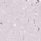 Galactose Mutarotase antibody, PA5-57285, Invitrogen Antibodies, Immunohistochemistry frozen image 