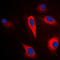 Keratin 16 antibody, LS-C352434, Lifespan Biosciences, Immunofluorescence image 