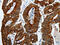 Keratin 19 antibody, CSB-PA165755, Cusabio, Immunohistochemistry paraffin image 