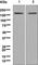 GLI Family Zinc Finger 1 antibody, ab134906, Abcam, Western Blot image 