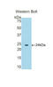 Cathepsin B antibody, LS-C293245, Lifespan Biosciences, Western Blot image 