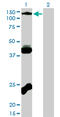 EPH Receptor B3 antibody, LS-C133175, Lifespan Biosciences, Western Blot image 