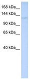 WD Repeat Domain 3 antibody, TA330338, Origene, Western Blot image 