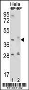 Hyaluronidase 2 antibody, 56-460, ProSci, Western Blot image 