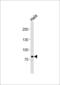 Proprotein Convertase Subtilisin/Kexin Type 9 antibody, 62-832, ProSci, Western Blot image 