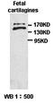 Proteoglycan 4 antibody, orb77398, Biorbyt, Western Blot image 