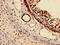 Rab Geranylgeranyltransferase Subunit Alpha antibody, CSB-PA852898LA01HU, Cusabio, Immunohistochemistry paraffin image 