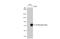 Interleukin 2 Receptor Subunit Beta antibody, GTX108495, GeneTex, Western Blot image 