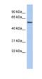 Chloride Intracellular Channel 3 antibody, orb329814, Biorbyt, Western Blot image 