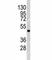 Integrin Linked Kinase antibody, F50639-0.4ML, NSJ Bioreagents, Western Blot image 