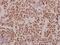 Potassium Voltage-Gated Channel Subfamily J Member 2 antibody, PA5-37452, Invitrogen Antibodies, Immunohistochemistry paraffin image 