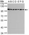 HPS3 Biogenesis Of Lysosomal Organelles Complex 2 Subunit 1 antibody, PA5-21868, Invitrogen Antibodies, Western Blot image 