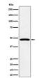 Protein Tyrosine Phosphatase Non-Receptor Type 2 antibody, M01597, Boster Biological Technology, Western Blot image 