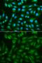 Sorbitol Dehydrogenase antibody, GTX54728, GeneTex, Immunofluorescence image 