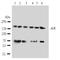 ALK Receptor Tyrosine Kinase antibody, orb76254, Biorbyt, Western Blot image 