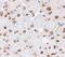 Alpha-ketoglutarate-dependent dioxygenase FTO antibody, NBP1-77021, Novus Biologicals, Immunohistochemistry paraffin image 