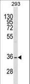 Single Stranded DNA Binding Protein 2 antibody, LS-C157096, Lifespan Biosciences, Western Blot image 