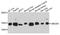 Ubiquitin Conjugating Enzyme E2 D4 (Putative) antibody, A13194, Boster Biological Technology, Western Blot image 