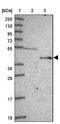 Ferrochelatase antibody, NBP2-33413, Novus Biologicals, Western Blot image 