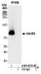 HAUS Augmin Like Complex Subunit 5 antibody, A305-827A-M, Bethyl Labs, Immunoprecipitation image 