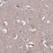 Transmembrane Channel Like 5 antibody, PA5-59834, Invitrogen Antibodies, Immunohistochemistry paraffin image 