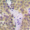 Serum/Glucocorticoid Regulated Kinase 1 antibody, GTX32413, GeneTex, Immunohistochemistry paraffin image 