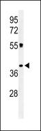 CMRF35-like molecule 1 antibody, LS-C168845, Lifespan Biosciences, Western Blot image 
