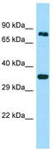 Protein Hook homolog 3 antibody, TA337954, Origene, Western Blot image 