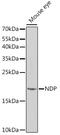 Norrin Cystine Knot Growth Factor NDP antibody, GTX33348, GeneTex, Western Blot image 