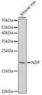 Norrin antibody, GTX33348, GeneTex, Western Blot image 