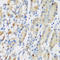 Ribonucleotide Reductase Catalytic Subunit M1 antibody, A01764, Boster Biological Technology, Immunohistochemistry frozen image 