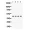 Actin Alpha 1, Skeletal Muscle antibody, LS-C407963, Lifespan Biosciences, Western Blot image 