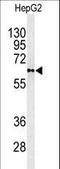 Phospholipid Transfer Protein antibody, LS-C100277, Lifespan Biosciences, Western Blot image 