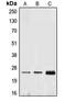 Ephrin A1 antibody, MBS820697, MyBioSource, Western Blot image 