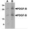 Sis antibody, MBS153626, MyBioSource, Western Blot image 