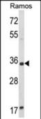 Aspartoacylase-2 antibody, PA5-72561, Invitrogen Antibodies, Western Blot image 