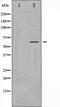 Calcium/Calmodulin Dependent Protein Kinase II Alpha antibody, abx010485, Abbexa, Western Blot image 