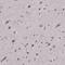 Arrestin Beta 1 antibody, NBP2-68897, Novus Biologicals, Immunohistochemistry paraffin image 