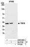 Tubulin Folding Cofactor B antibody, A305-465A, Bethyl Labs, Immunoprecipitation image 