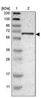 EMAP Like 2 antibody, PA5-52980, Invitrogen Antibodies, Western Blot image 