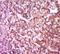 TRNA Methyltransferase 61B antibody, orb186382, Biorbyt, Immunohistochemistry paraffin image 